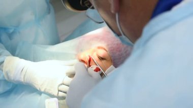 cerrah dermatolog yara cerrahi olarak çıkarılması bir köstebek ya da bir kadının yüzünde nevus sonra tasarlamak.