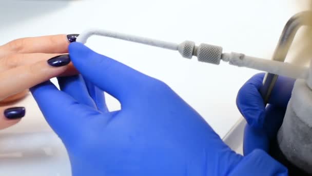 Удаление папилломы и бородавок на руке жидким азотом — стоковое видео