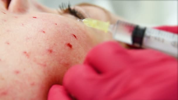 Läkare kosmetolog hudläkare bedriver en session av mesotherapy för en äldre kvinna. — Stockvideo