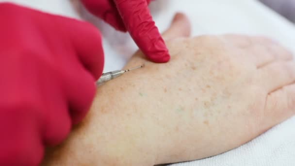 Врач-косметолог дерматолог проводит сеанс мезотерапии или биоревитализации-удаления пигментации на руках пожилых женщин . — стоковое видео