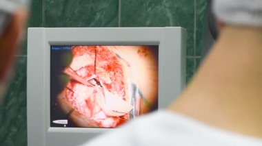 beyin ameliyatı bir İzleyicisi'nde nöroşirurji gözlemlemek