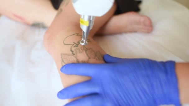 De schoonheidsspecialist verwijdert de tatoeage op het been van een jong mooi meisje met een laser. — Stockvideo