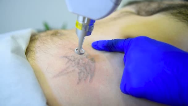 Schoonheidsspecialist arts verwijdert tattoo geduldige man professionele laser. — Stockvideo