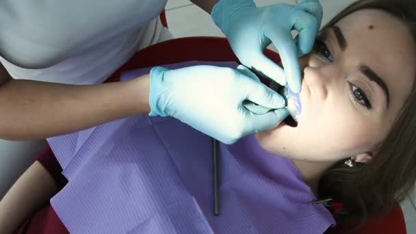 Zubař je obsazení zubů pro protetiku — Stock video