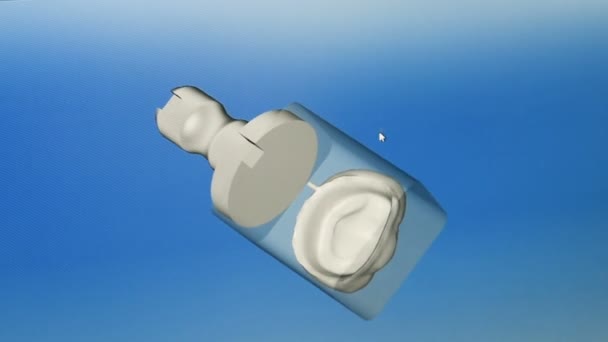 Numérisation 3D de prothèse dentaire à partir de gypse — Video