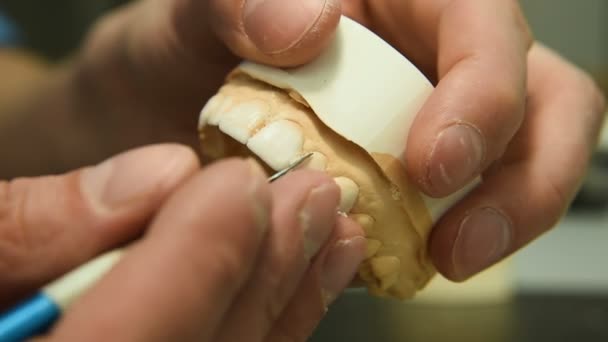 Fogorvos fogászati implantátum teszi — Stock videók