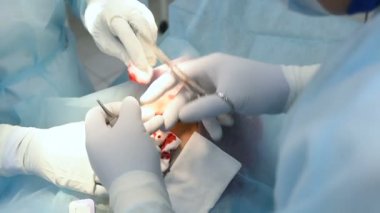 cerrah dermatolog yara cerrahi olarak çıkarılması bir köstebek ya da bir kadının yüzünde nevus sonra tasarlamak.