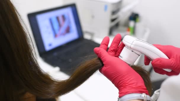 Médico dermatologista diagnostica a estrutura do cabelo de uma jovem menina bonita com uma ferramenta especial - um tricoscópio . — Vídeo de Stock