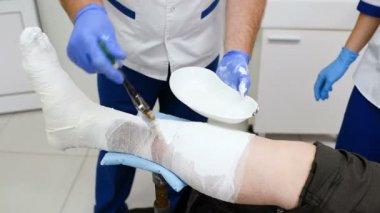 Doktor traumatologist bir sıva hastanın kırık bacak koyar..