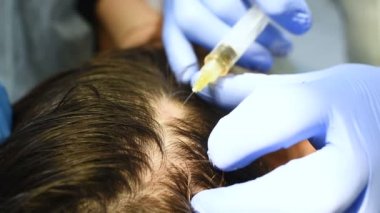 Doktor kozmetolog dermatolog plazmayı hastanın kafa derisine enjekte ediyor..