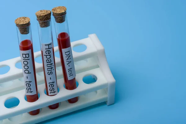 Teste de Hepatite e Teste de DNA in Vitro . — Fotografia de Stock