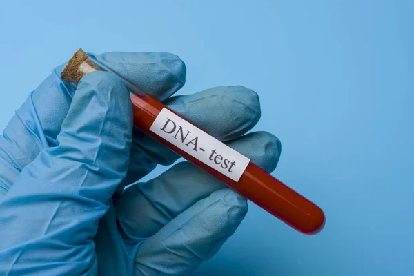 Mão Segurando um teste de DNA em um tubo de ensaio em um fundo azul . — Fotografia de Stock