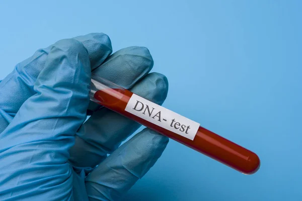 Mão Segurando um teste de DNA em um tubo de ensaio em um fundo azul . — Fotografia de Stock