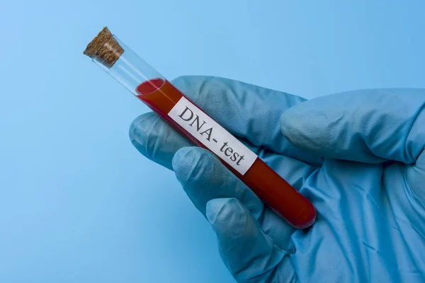 Mão Segurando um teste de DNA em um tubo de ensaio em um fundo azul . — Fotografia de Stock