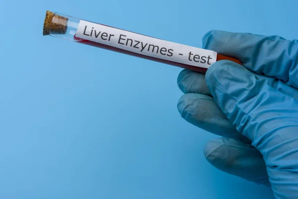 Рука тримає печінковий фермент Тест in vitro на синьому фоні . — стокове фото