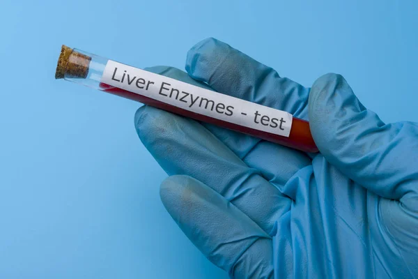 Mavi arka planda el tutma karaciğer enzim testi in vitro.