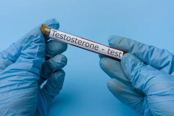 Hand Holding test testeron in vitro mot en blå bakgrund. — Stockfoto