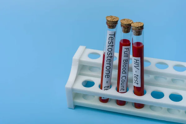 Test testosteron full blod prov och hiv-test in vitro. — Stockfoto