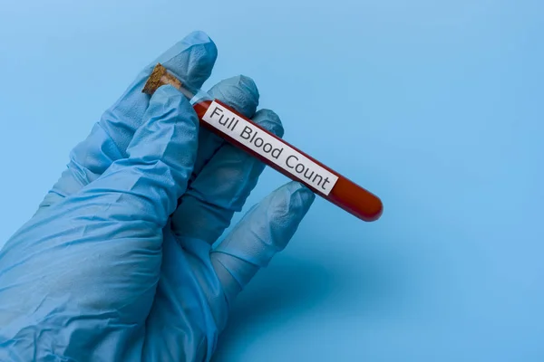Mano che effettua un test per un esame del sangue completo in una provetta su sfondo blu . — Foto Stock