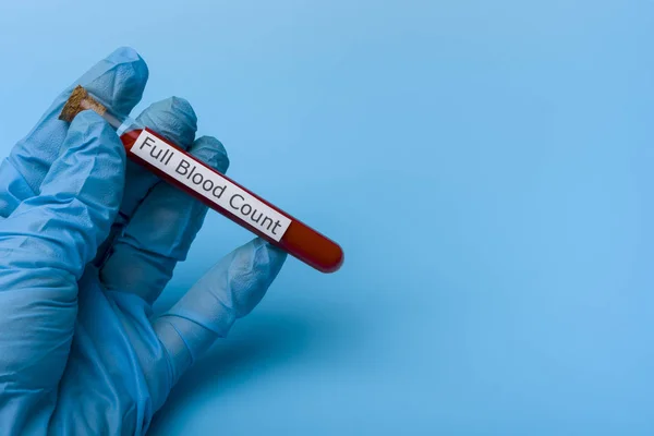 Mão segurando um teste para um teste de sangue completo em um tubo de teste em um fundo azul . — Fotografia de Stock