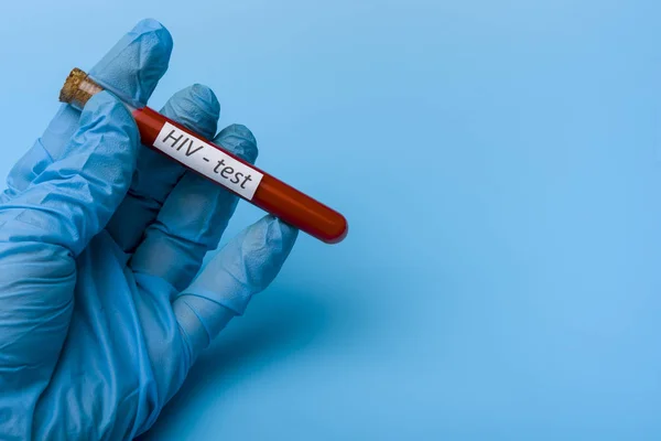Mão Segurando um teste de HIV em um tubo de teste em um fundo azul . — Fotografia de Stock