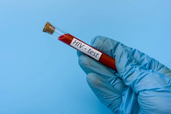 Mano che effettua un test per un esame del sangue completo in una provetta su sfondo blu . — Foto Stock