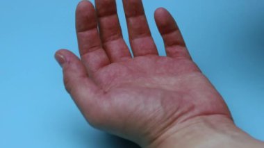 Haplar mavi arka planda eline düşer. İlaç ve bağımlılık kavramı.