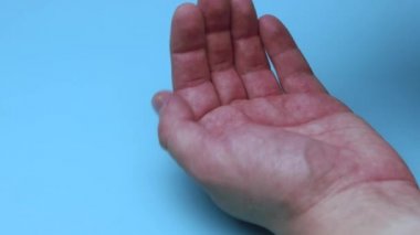 Omega 3 vitaminleri avuçlarına döküldü. Vitaminleri elinde tut. Açık sarı kapsüllerde doğal Omega 3 'ü kabul edin. Sağlıklı bir yaşam tarzı. Doktor ilaçları yazdı..
