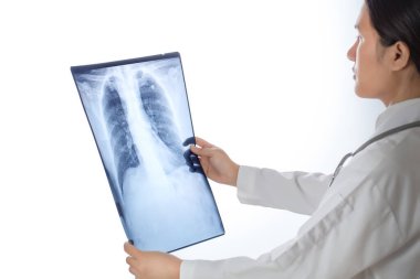 Doktor beyaz arka planda göğüs röntgeni çekiyor..