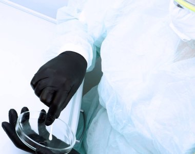 Virüslü hastanın analizi. Tıbbi örnek incelemesi..