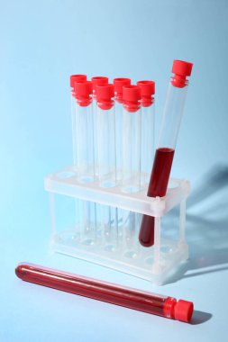 Mavi arka planda üzerinde kan olan test tüpleri. Kavram analizleri. Denge.
