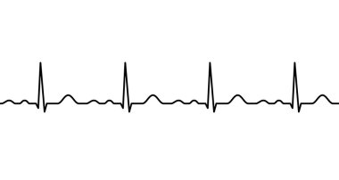 EKG hattı. Kalp atışı.