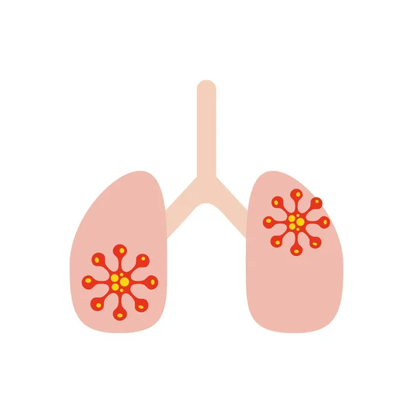 Concepto de coronavirus, icono de pulmones infectados, estilo plano — Vector de stock