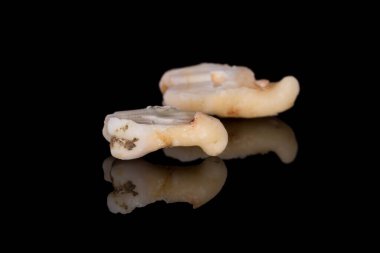 Yatay renk görüntüsü ve eğimli kökü olan sağ alt üçüncü azıdişi yan görünümü 