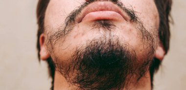 Bir adamın yüzünde yamalı sakal