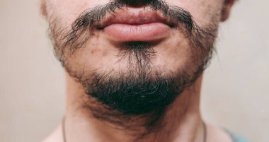Bir adamın yüzünde yamalı sakal
