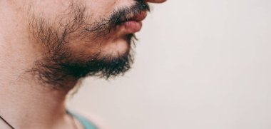 Bir adamın yüzünde yamalı sakal