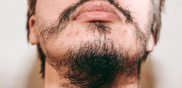 Fragmentarische Baard Het Gezicht Van Een Man — Stockfoto