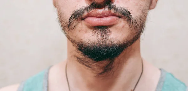 Patchy Beard Man Face — Stock Photo, Image