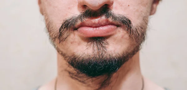 Patchy Beard Man Face — Stock Photo, Image