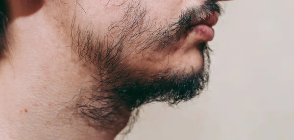 Bir adamın yüzünde yamalı sakal