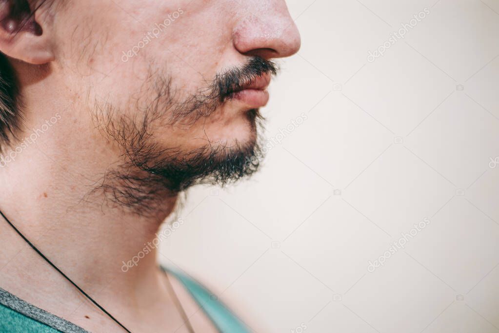 Patchy beard on a man's face