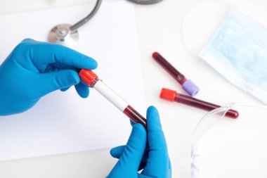 Corona virüsü salgını. Salgın Virüsü Solunum Sendromu.