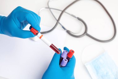 Corona virüsü salgını. Salgın Virüsü Solunum Sendromu.