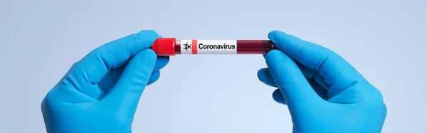 Brote Del Virus Corona Virus Epidémico Síndrome Respiratorio — Foto de Stock