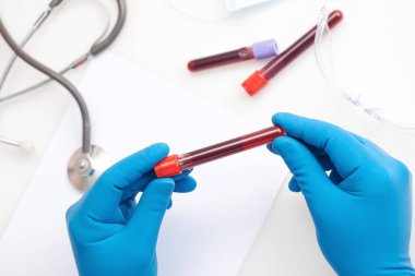 Corona virüsü salgını. Salgın Virüsü Solunum Sendromu.