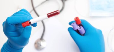 Corona virüsü salgını. Salgın Virüsü Solunum Sendromu.