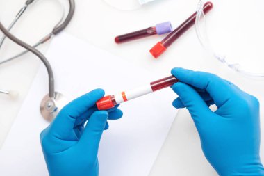 Corona virüsü salgını. Salgın Virüsü Solunum Sendromu.