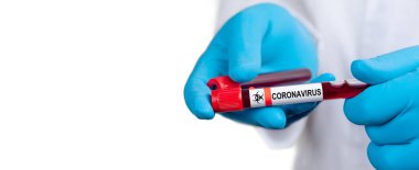 Corona virüsü salgını. Salgın Virüsü Solunum Sendromu.