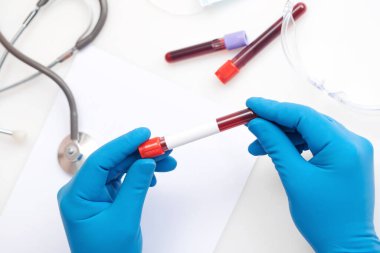 Corona virüsü salgını. Salgın Virüsü Solunum Sendromu.